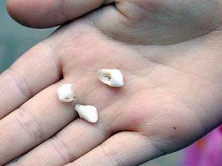 Японские ученые из университета Нагоя объявили об открытии банка молочных зубов