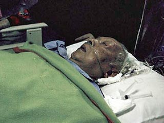 Состояние здоровья бывшего президента Индонезии Сухарто, находящегося в реанимации в одной из больниц Джакарты, несколько улучшилось, он пришел в сознание, сообщили сегодня лечащие его медики