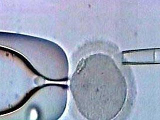 Британским ученым удалось создать человеческий эмбрион от трех родителей, передает Reuters. По их замыслу, это должно помочь в лечении многих заболеваний, передающихся по наследству