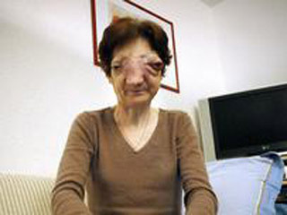 Первая во Франции просьба об эвтаназии, которую подала 52-летняя Шанталь Себир, страдающая неизлечимой и прогрессирующей болезнью, отклонена