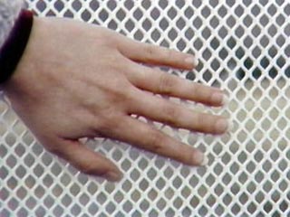 Палец Спиевака сейчас "полностью чувствителен, полностью подвижен". На нем растет ноготь и имеется обычный кожный рисунок