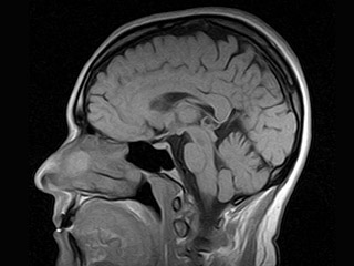 Сейчас наши исследователи присматриваются к методу MRI (в российской печати называется МРТ - магнитно-резонансная томография)