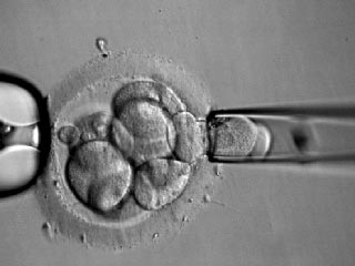 В России начали практиковать методику генетической диагностики эмбрионов