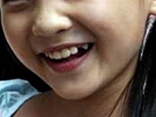 Китайская девочка непрерывно смеется уже 12 лет 
