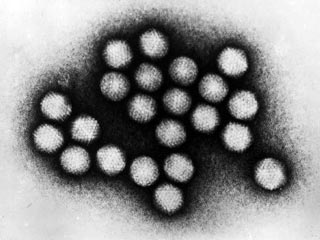 Ученые открыли вирус, который вызывает полноту. Подхватить его так же легко, как простуду