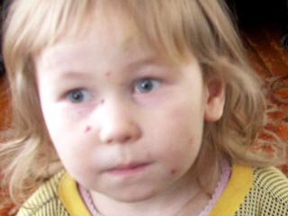 Пропавшая в Приморье четырехлетняя девочка найдена мертвой