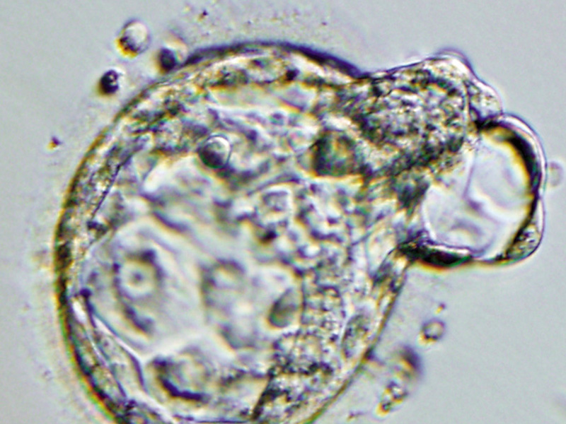 Семейным парам могут разрешить оставлять себе эмбрионы для создания новых частей тела и лечения болезней