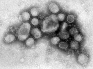 В США представители органов здравоохранения в среду заявили, что, согласно данным исследований, люди, родившиеся до 1957 года, обладают некоторым иммунитетом к вирусу гриппа A/H1N1
