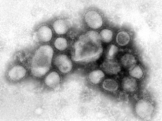 В России выявлены три новых зараженных свиным гриппом