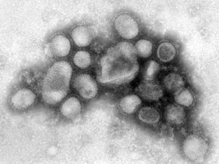 В Португалии зафиксирована первая смерть от свиного гриппа