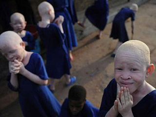 Более 10 тысяч альбиносов Африки вынуждены прятаться от внешнего мира из-за боязни быть покалеченными и убитыми из-за цвета свой кожи