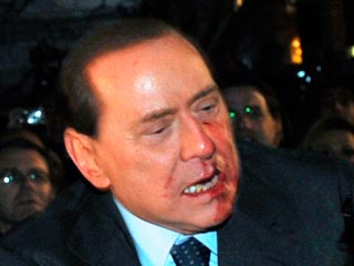 Премьер-министр Италии Сильвио Берлускони, которому в воскресенье в Милане разбил лицо один из сограждан, покинет больницу лишь в среду