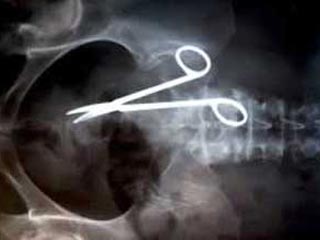 В 2004 году у австралийца Пэта Скиннера спустя 18 месяцев после операции в брюшной полости были обнаружены ножницы
