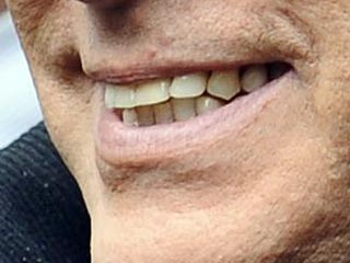 Итальянский премьер Сильвио Берлускони заявил, что после декабрьского нападения на него в Милане у него осталось 35 зубов, передал сайт Life in Italy сообщение агентства ANSA