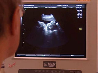 Скотт Мур - второй "беременный мужчина" в мире, заявивший о себе публично, - должен родить мальчика в феврале