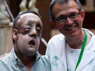 В Испании показали пациента, которому сделали операцию по частичной пересадке лица