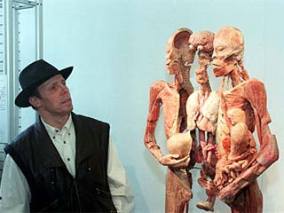 Скандально известный немецкий художник-патологоанатом Гюнтер фон Хагенс, прозванный прессой "новым Франкенштейном", распродает по частям человеческие трупы из коллекции