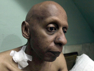Власти Кубы в субботу сообщили, что состояние здоровья объявившего голодовку оппозиционера Гильермо Фариньяса ухудшилось, и он может умереть из-за образования тромба в шее