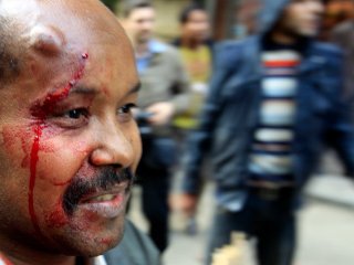 Японский телеоператор получил ранение во время беспорядков, возникших в среду в центре Каира