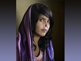 Шокирующая фотография афганской девушки, которой муж-талиб отрезал уши и нос за попытку сбежать от него, получила в пятницу главный приз World Press Photo