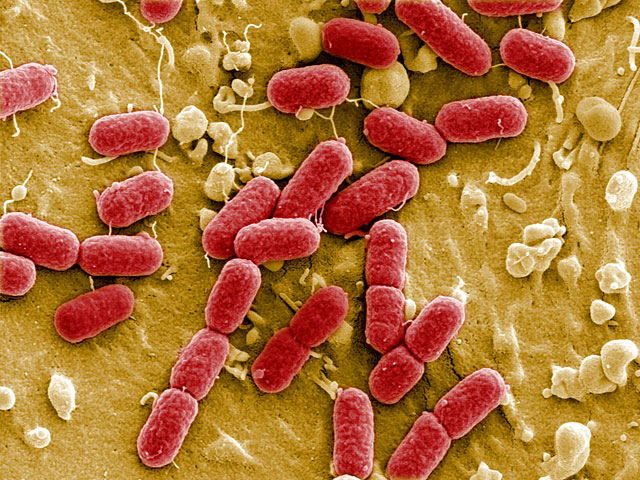 В Чехии смертельно опасная бактерия E.coli, вызывающая кишечную инфекцию, обнаружена в бутылках с водой
