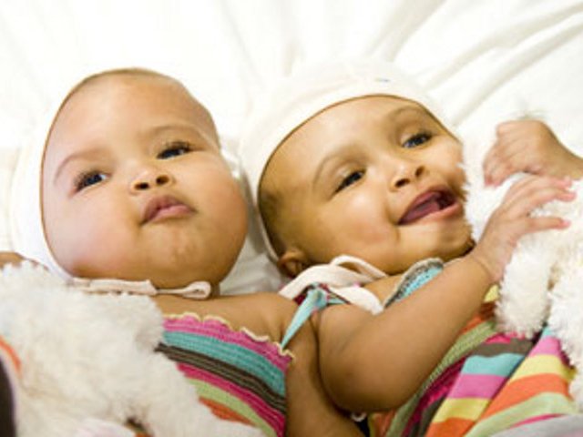 Британские хирурги в ходе серии операций успешно разделили сиамских близнецов, сросшихся в области головы
