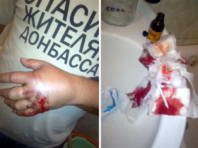 Киевлянин Андрей Орест был ранен неизвестными из-за футболки с надписью "Спасибо жителям Донбасса"