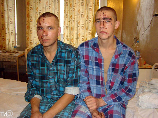 5 дней в Российской армии: братья-призывники сбежали из вологодской части после избиения до потери сознания