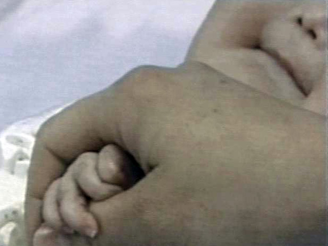 В минувшие выходные сразу десять детей возрасте от восьми месяцев до двух лет оказались в реанимации после инъекции обезболивающего в одной из больниц города Братска Иркутской области