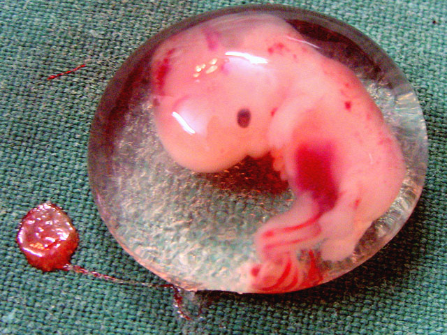 Бочки с десятками человеческих эмбрионов обнаружены в Невьянском районе Свердловской области. Как сообщают в местной полиции, страшная находку сделали вечером 22 июля грибники в овраге неподалеку от трассы Нижний Тагил - Екатеринбург