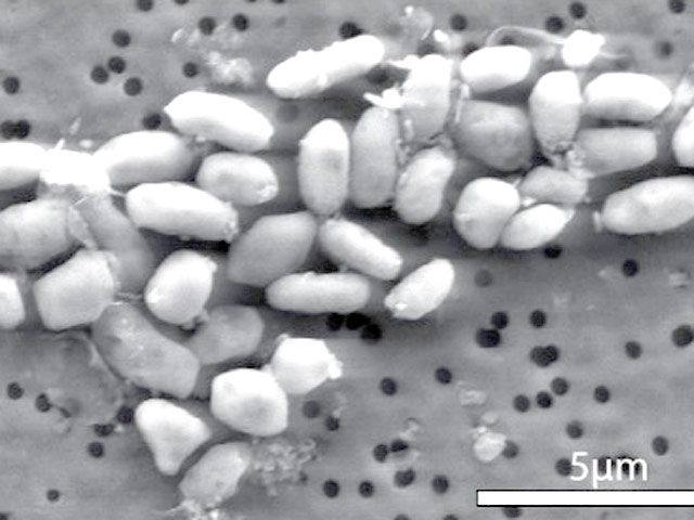 Ученые выяснили, что бактерия GFAJ-1 просто умеет вылавливать фосфат из окружающей среды, даже находясь в мышьяке