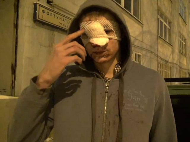 Собственную версию пострадавший Александр Карноухов с забинтованным лицом изложил на видео в YouTube