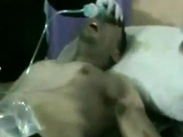 На возможное применение боевиками ядовитого газа зарин указывают данные, которые передали пострадавшие и врачи экспертам учрежденной ООН Комиссии по расследованию возможных нарушений прав человека в Сирии