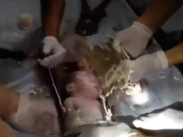 В Китае спасли застрявшего в трубе новорожденного, которого смыла в канализацию мать