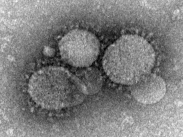По решению ВОЗ новый коронавирус теперь называют "синдром респираторного коронавируса Ближнего Востока" ("Middle East Respiratory Syndrome Coronavirus", или MERS)