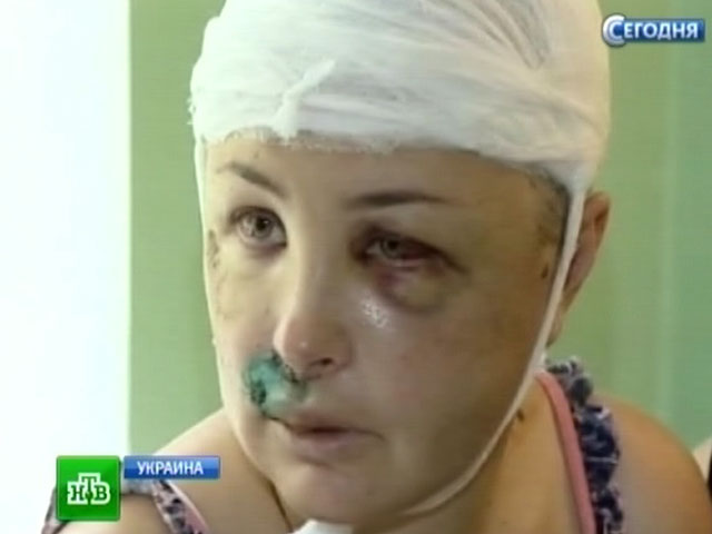 Изнасилованная украинка рассказала, как пряталась от милиционеров, хотевших ее добить