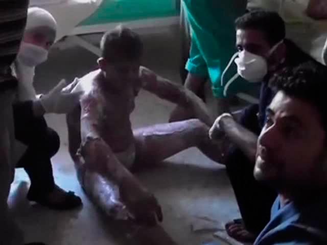 Американские телеканалы в субботу продемонстрировали видеозаписи жертв и пострадавших от применения, как утверждают власти США, химического оружия сирийским режимом