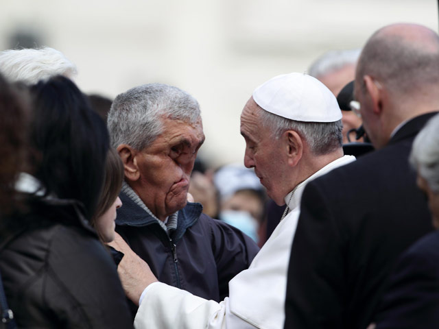 Во время общей аудиенции на площади Святого Петра понтифик обнял изуродованного язвами человека, страдающего 15 лет от нейрофиброматоза