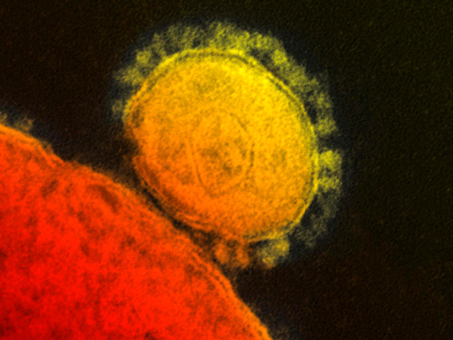Власти Саудовской Аравии объявили, что за последние два дня умерли еще 10 человек, инфицированных коронавирусом ближневосточного респираторного синдрома (MERS-CoV), за этот же период было выявлено еще 20 новых случаев заражения