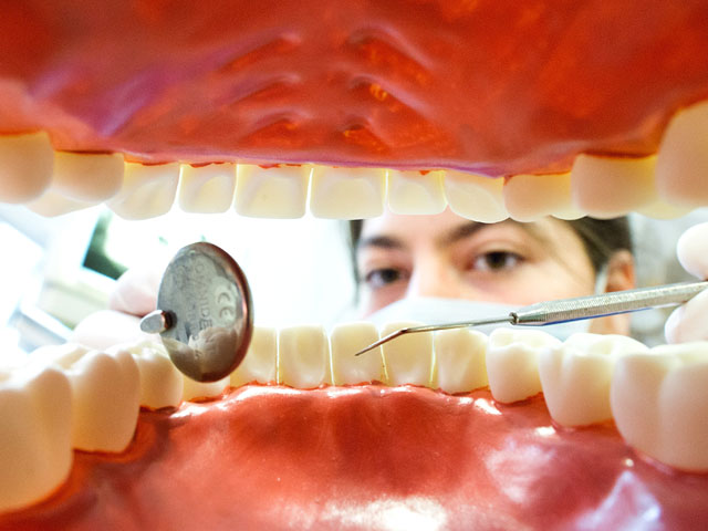 Уникальную операцию провели врачи в Индии: они удалили 232 зуба изо рта 17-летнего пациента