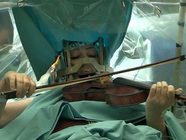 Литовская скрипачка во время операции на мозге успешно сыграла произведения Моцарта и Чайковского