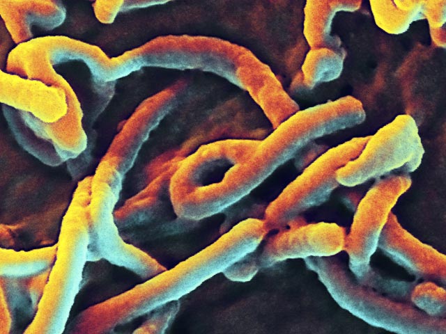 Если ранее Всемирная организация здравоохранения (ВОЗ) утверждала, что число зараженных лихорадкой Эбола может превысить 20 тысяч человек, то сейчас речь идет о десятках и сотнях тысяч