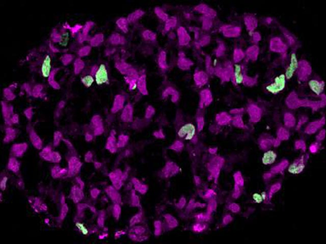 Ученые превратили клетки человеческой кожи в сперматозоиды и яйцеклетки