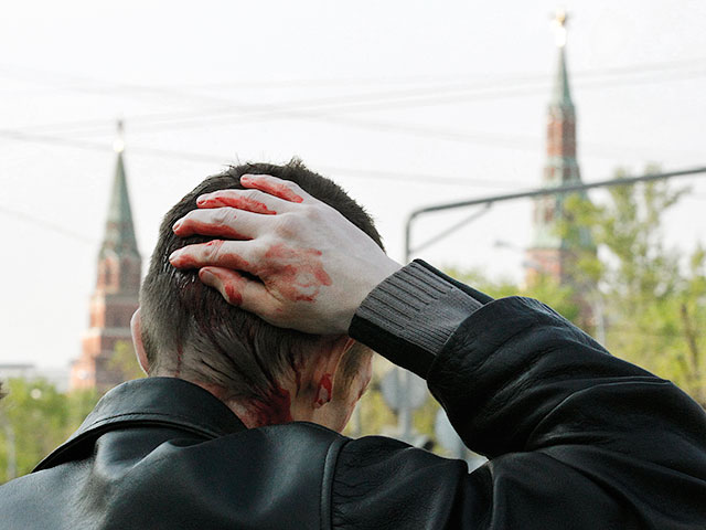 Правозащитники подсчитали, сколько человек погибло  пострадало с начала этого года в России от нападений на почве национальной ненависти