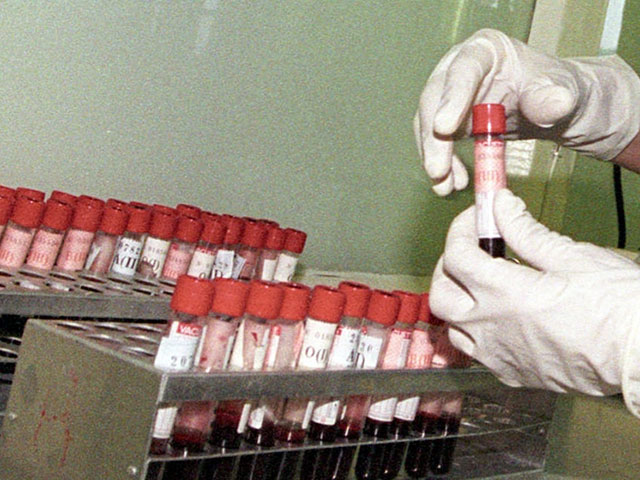 Первое массовое обследование на гепатит C в Подмосковье заставило специалистов говорить об эпидемии