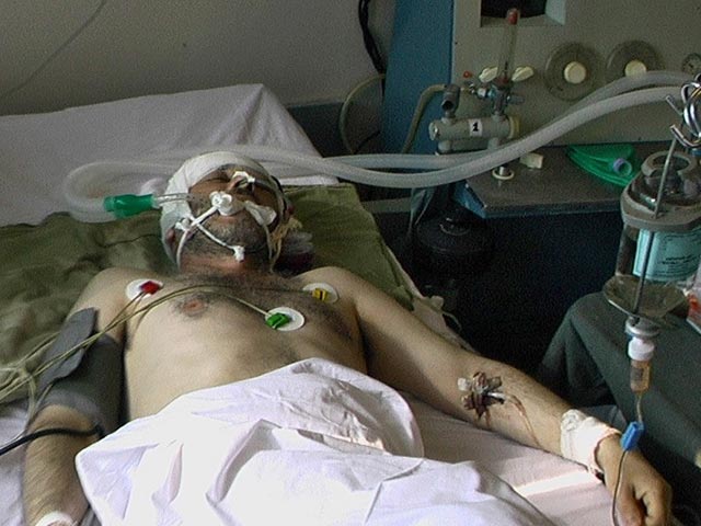 По официальным данным, Гвазава был ранен в голову в результате возможной засады на трассе Тбилиси-Табахмела. Его доставили в тяжелом состоянии в клинику Ингороква