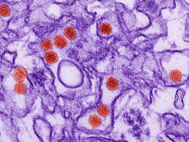 Вирус Зика, получивший широкое распространение в Латинской Америке, был открыт в 1947 году в Уганде