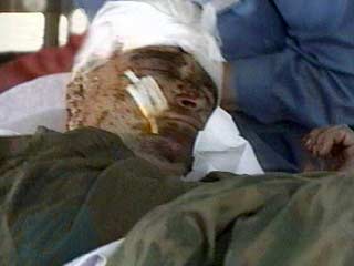 В Кабуле скончался британский миротворец, получивший накануне тяжелое огнестрельное ранение в голову