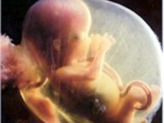 Сторонники абортов считают, эмбрион не может иметь статус родившегося младенца