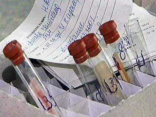 В Иркутской области зарегистрировано 13,5 тысячи ВИЧ-инфицированных